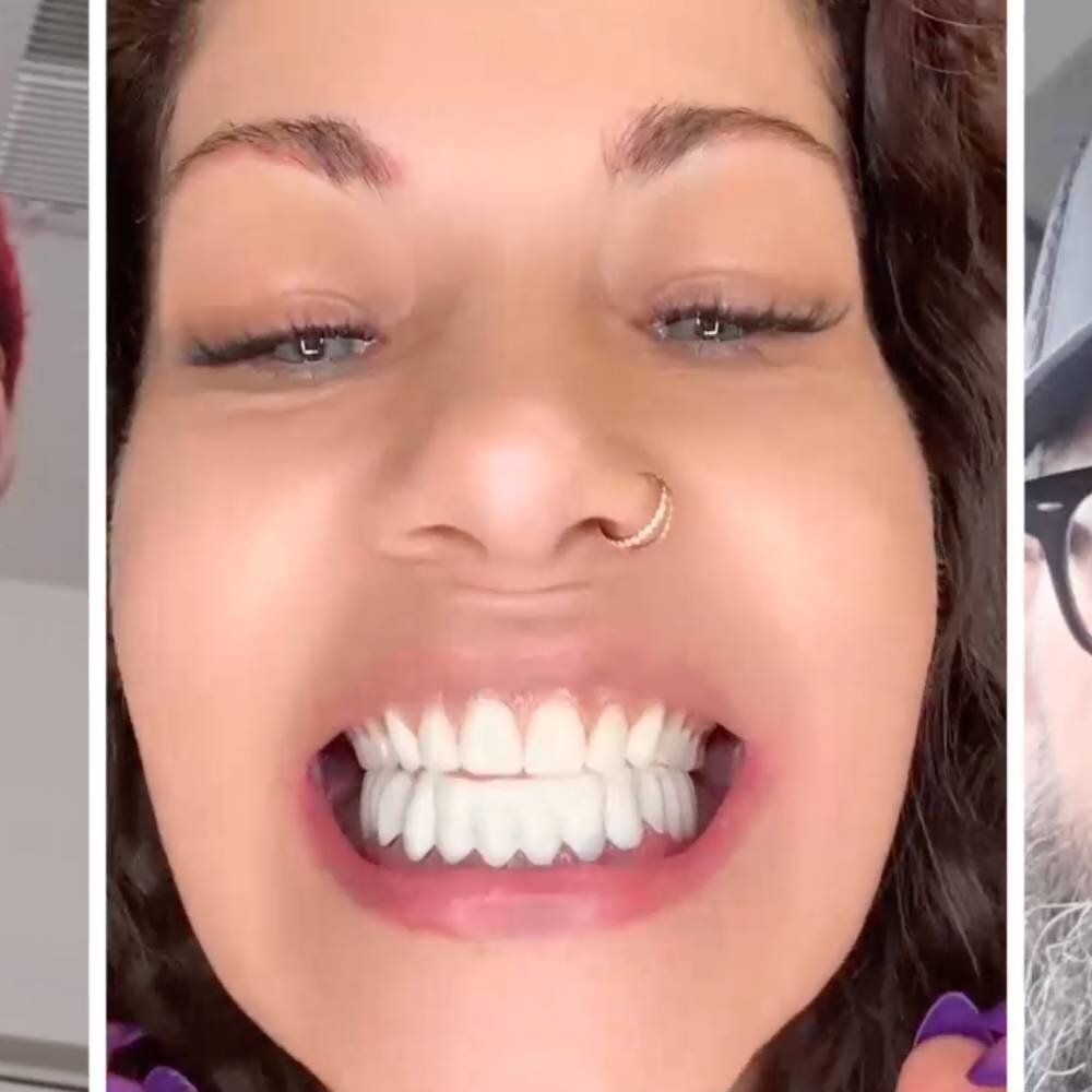 Verschillende mensen die glimlachen met de WellaSmile-facetten
